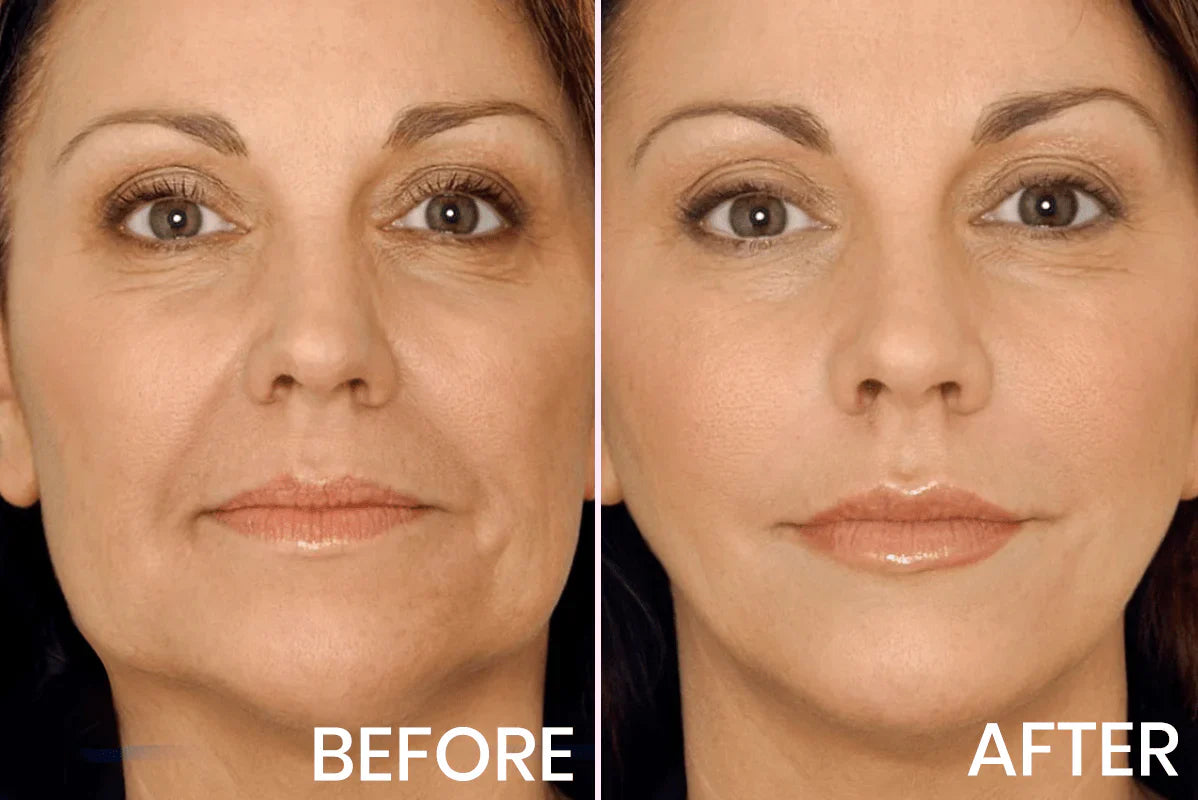 Advanced Firming & Wrinkle-Reducing Cream