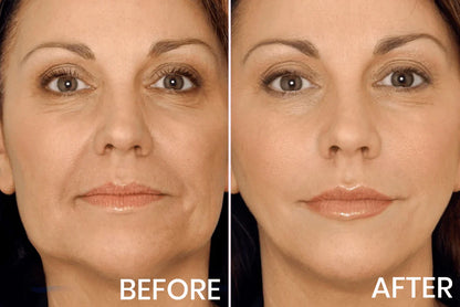 Advanced Firming & Wrinkle-Reducing Cream